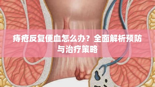 痔疮反复便血怎么办？全面解析预防与治疗策略
