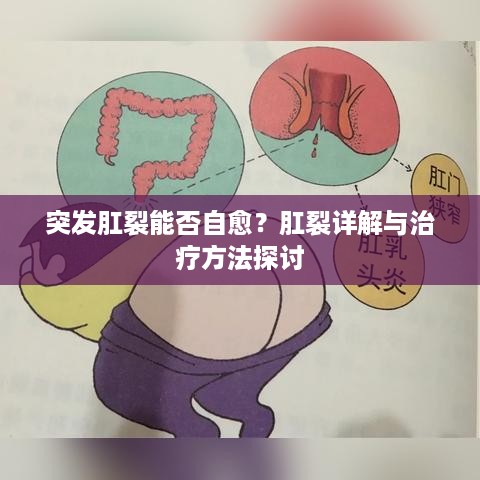 突发肛裂能否自愈？肛裂详解与治疗方法探讨