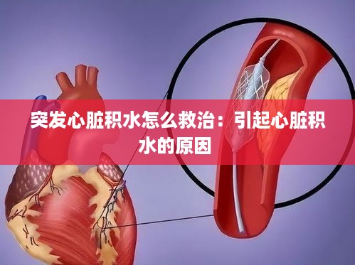 突发心脏积水怎么救治：引起心脏积水的原因 