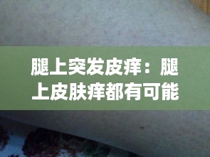 腿上突发皮痒：腿上皮肤痒都有可能是什么病? 