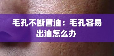 毛孔不断冒油：毛孔容易出油怎么办 