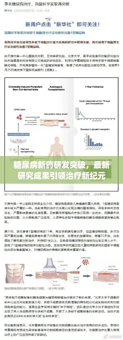糖尿病新药研发突破，最新研究成果引领治疗新纪元