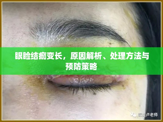 眼睑结痂变长，原因解析、处理方法与预防策略