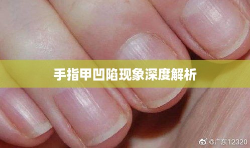 手指甲凹陷现象深度解析