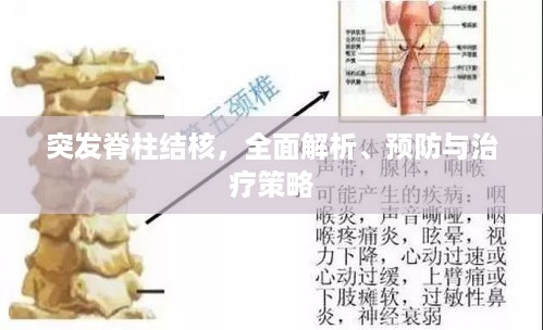 突发脊柱结核，全面解析、预防与治疗策略