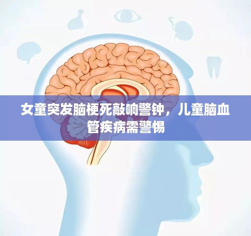 女童突发脑梗死敲响警钟，儿童脑血管疾病需警惕